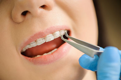 Aparelhos Dentários Orthopride Lapa | Odontologia e Estética